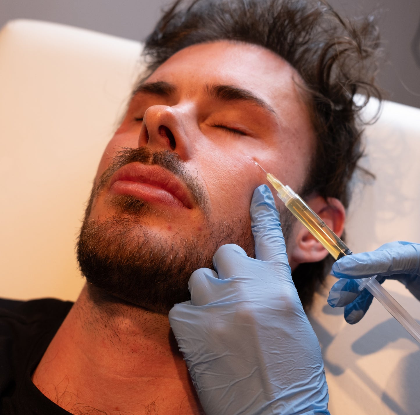 Carbon Facial