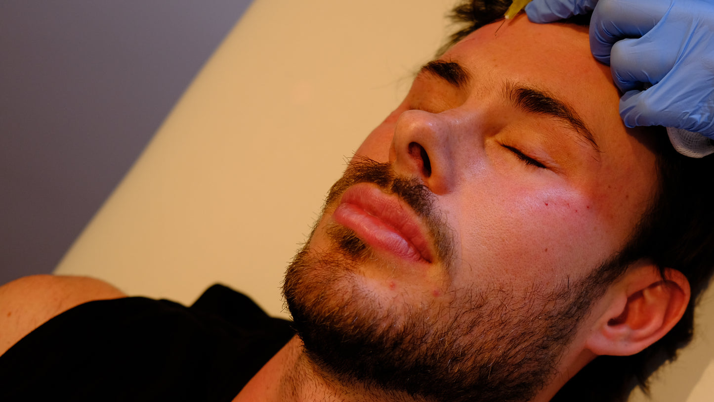 Carbon Facial