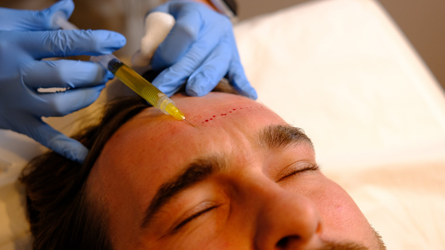 Carbon Facial
