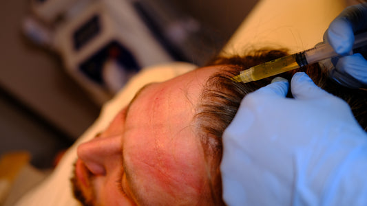PRP Hair Treatment