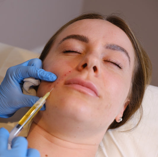 Carbon Facial
